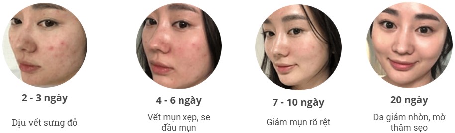 Xịt dưỡng Mioskin từ tế bào gốc Chính Hãng 18 Xịt dưỡng Mioskin từ tế bào gốc Chính Hãng