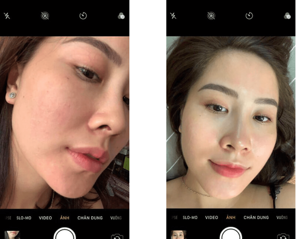 Xịt dưỡng Mioskin từ tế bào gốc Chính Hãng 20 Xịt dưỡng Mioskin từ tế bào gốc Chính Hãng